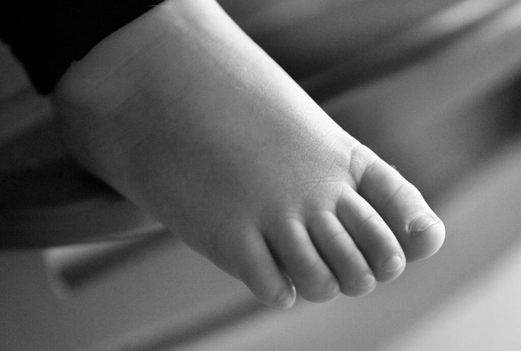 Kids’ Foot Problems